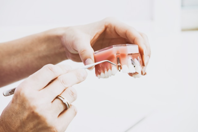 smoking and dental implants