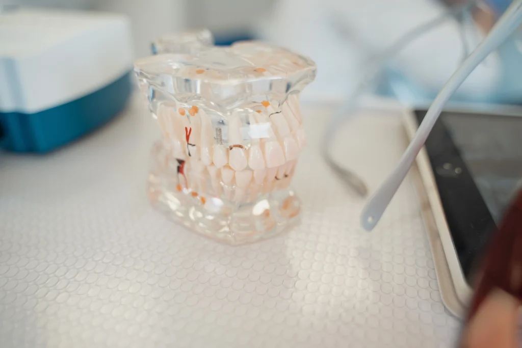 dental implants vs dentures​