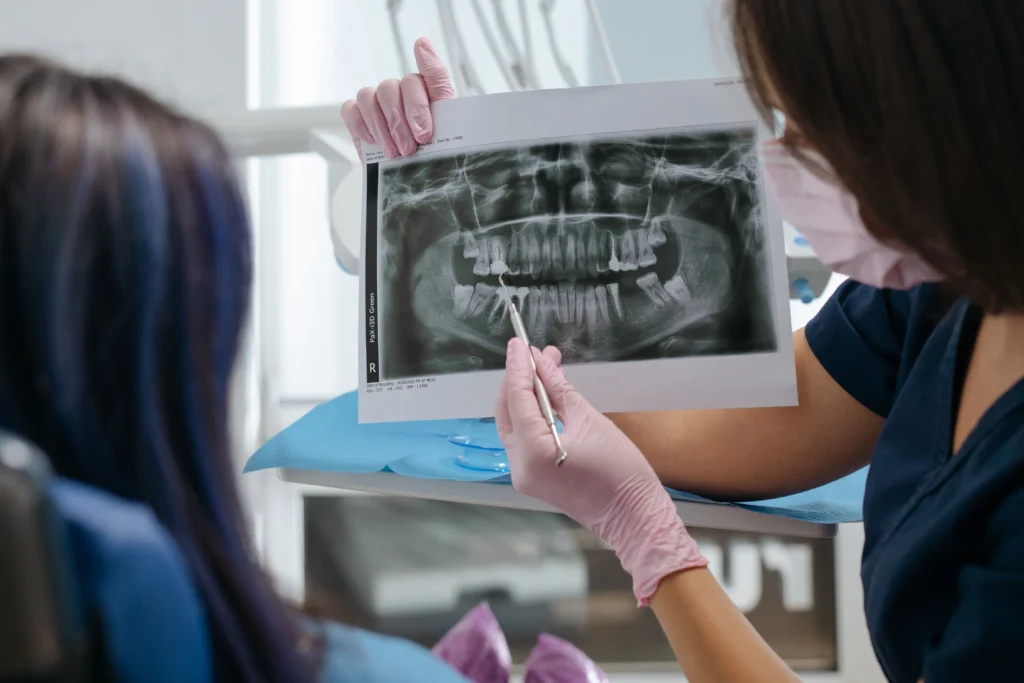 root canal vs dental implants